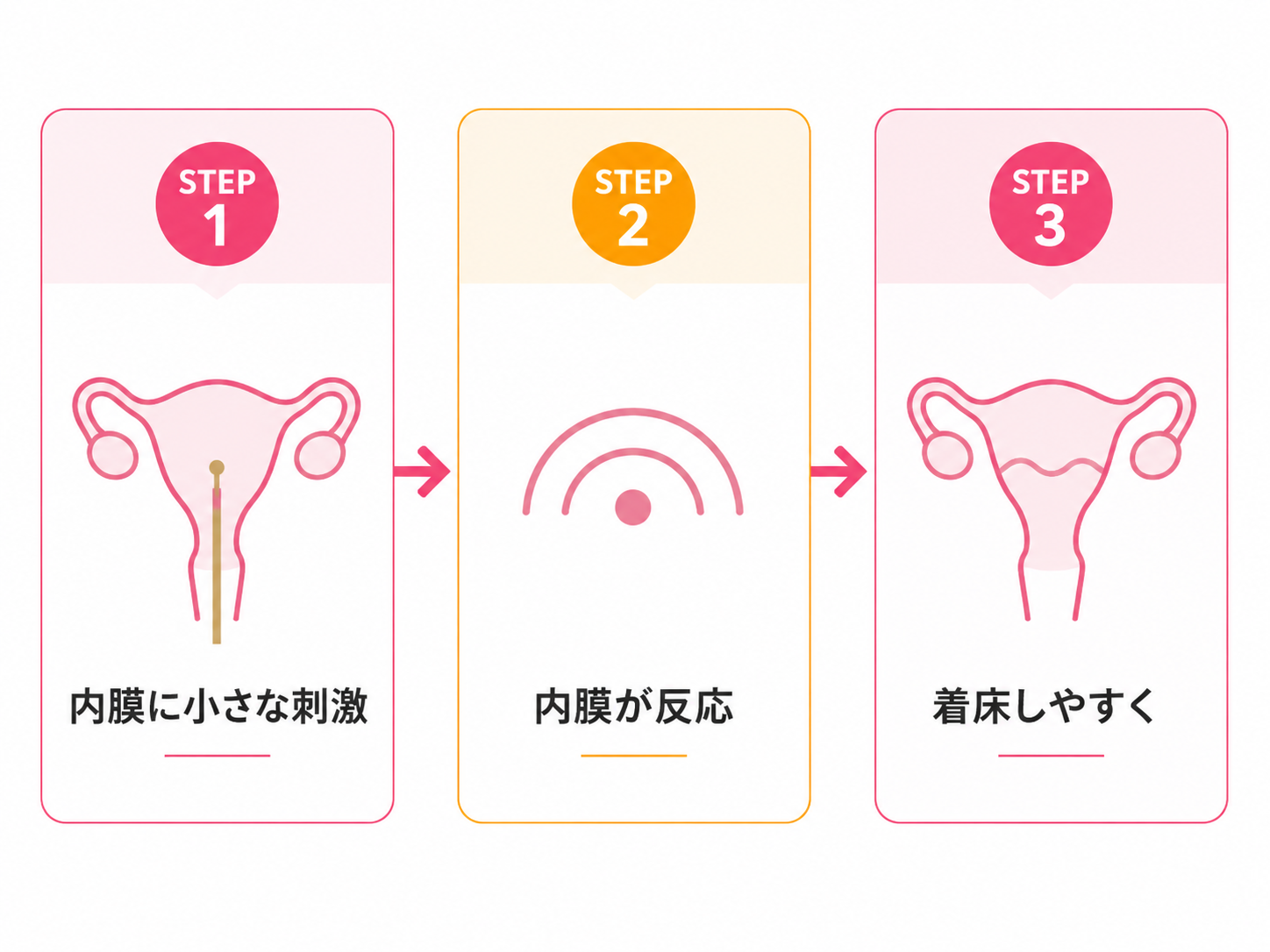子宮内膜スクラッチ図解